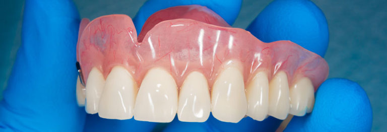 Prothèse dentaire : faire le bon choix pour sa dentition | #site_title